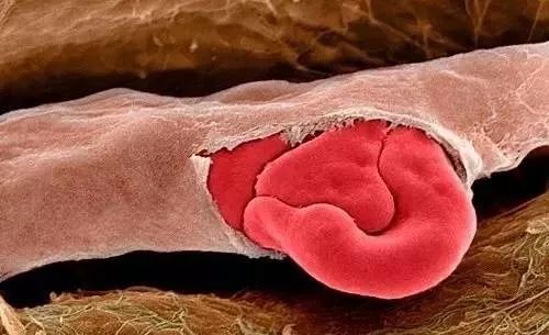 脸上痘印多久会自行消失,在脸上挤痘痘留下的痘印会消失吗