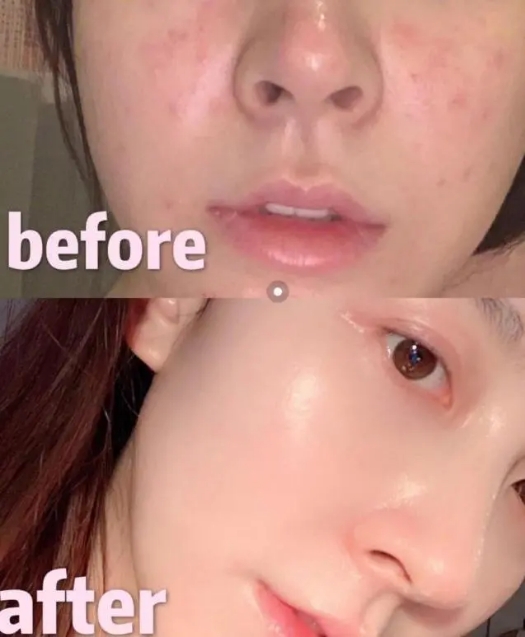 屈臣氏好用的精华和面霜,屈臣氏好物精华推荐