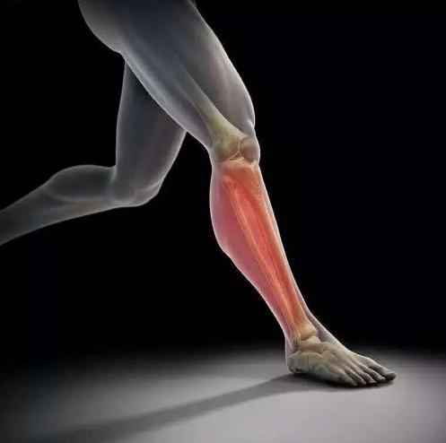 小腿胫骨骨膜炎训练,小腿内侧胫骨疼恢复训练