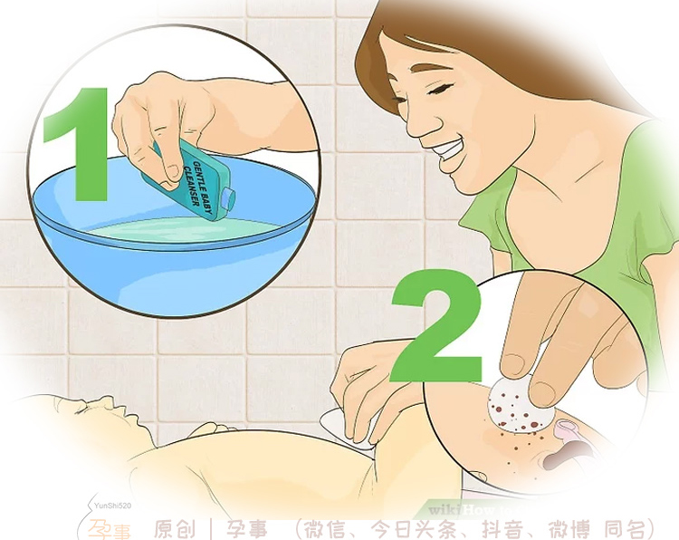 脐带发炎如何预防感染,新生儿脐带感染怎么处理