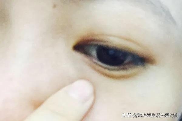 眼皮跳怎么消除不好的运势,眼皮跳和运气有关这科学吗