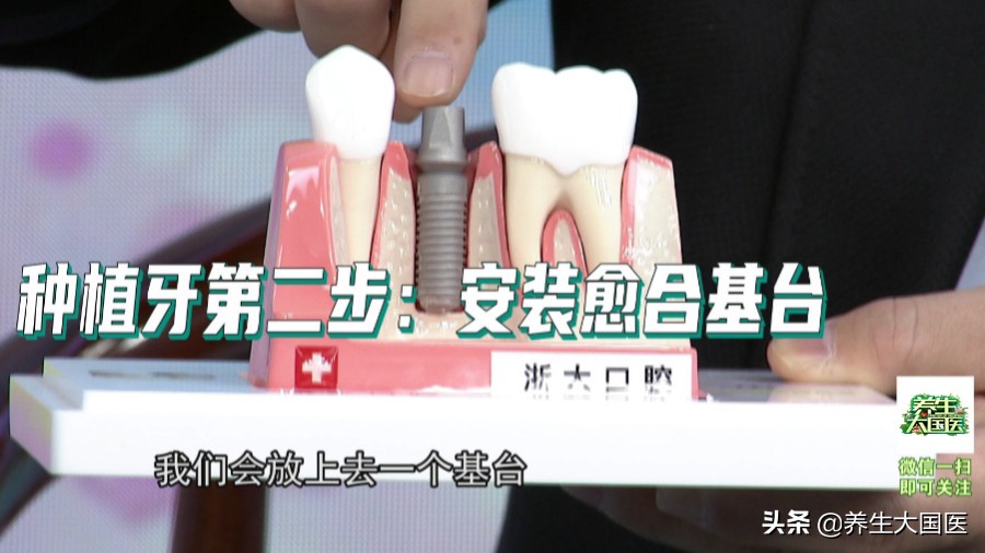 牙齿不整齐怎么修复最快,牙齿不好看如何迅速矫正