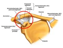 武磊肩伤到底做不做手术,武磊肩伤到底是多重