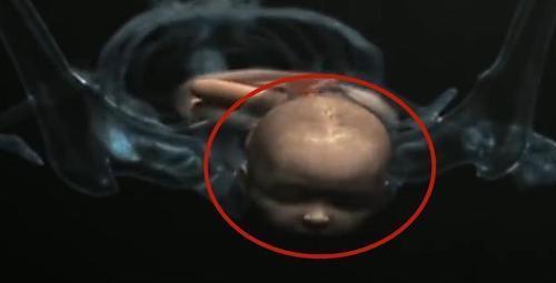 产道那么小怎么顺产,产道那么小胎儿怎么出来的