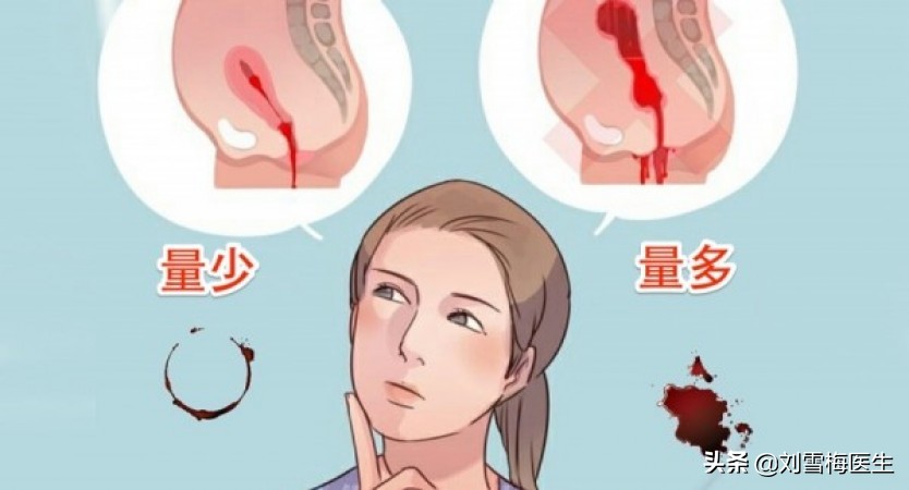 月经不来如何备孕更容易怀孕,一招教你改善月经不调快速备孕