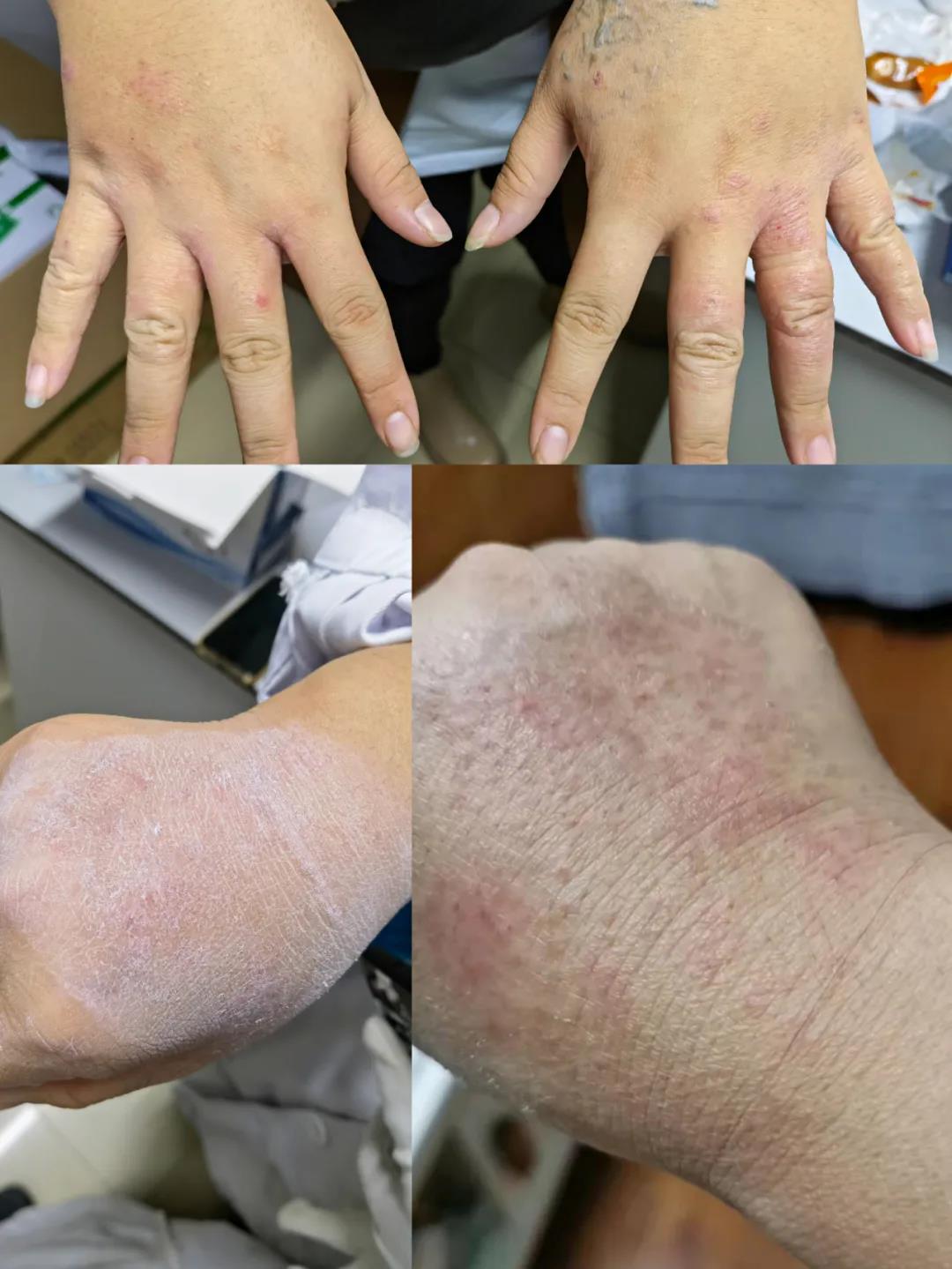 月圆日疫情来袭同战疫只争朝夕