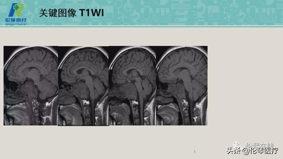 上海教授詹松华,上海曙光医院詹松华简介