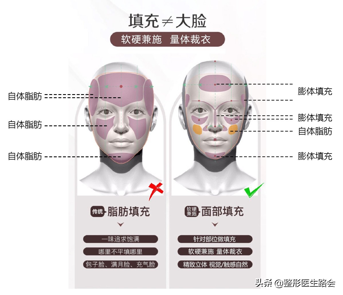 戴牙套导致脸颊凹陷怎么办,戴牙套导致太阳穴突出