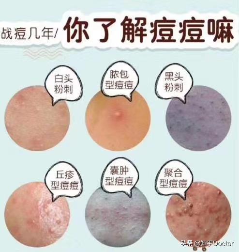 *疮痤**和毛囊炎完全不是一种病，正确区别，不可一概而论