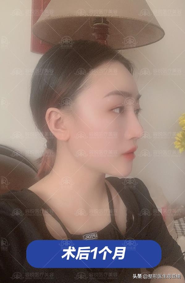 塌鼻妹逆袭,塌鼻妹