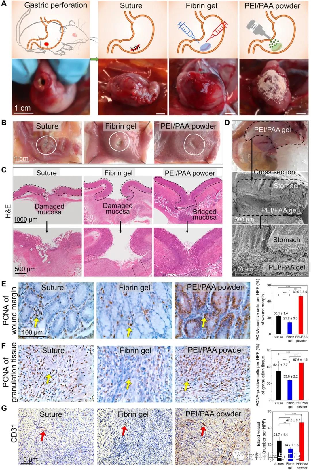 Science子刊:涂点粉,加点水,2秒就让伤口愈合、止血?