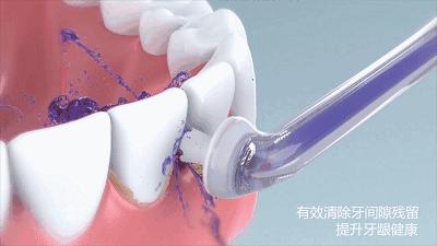 牙齿为什么有白斑点,牙齿脱矿白斑用涂氟剂可以修复吗