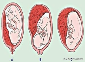 《大江大河》宋运萍轻轻一摔“一尸两命”，产科医生道出了实情