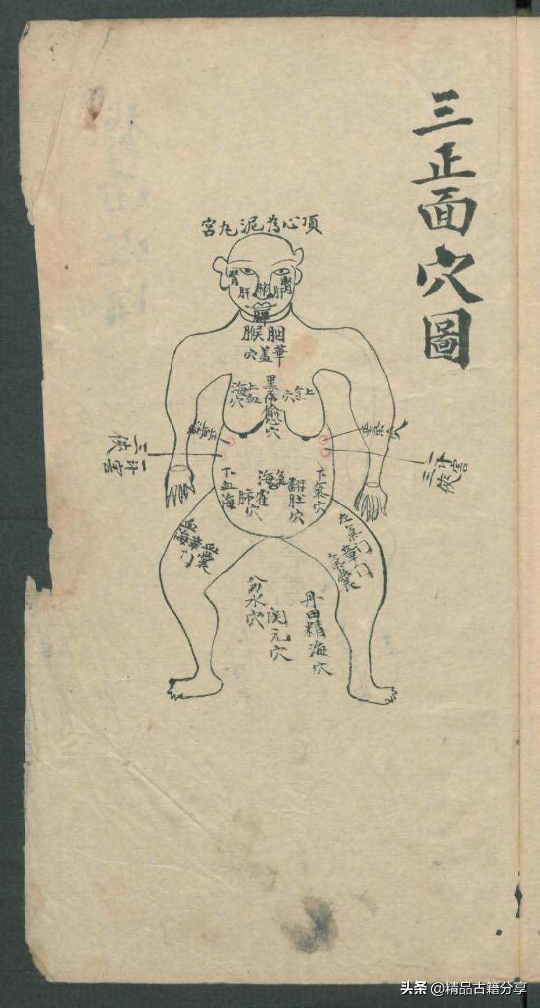 中医类抄本跌打损伤方面的医书欢迎阅读