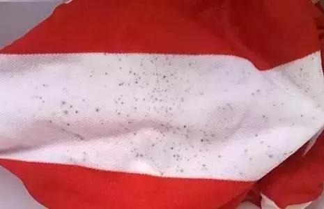 衣物上黑霉点怎么去除,衣物霉斑黑点