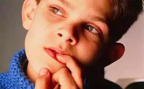 宝宝总爱啃东西怎么办,宝宝老爱啃指甲