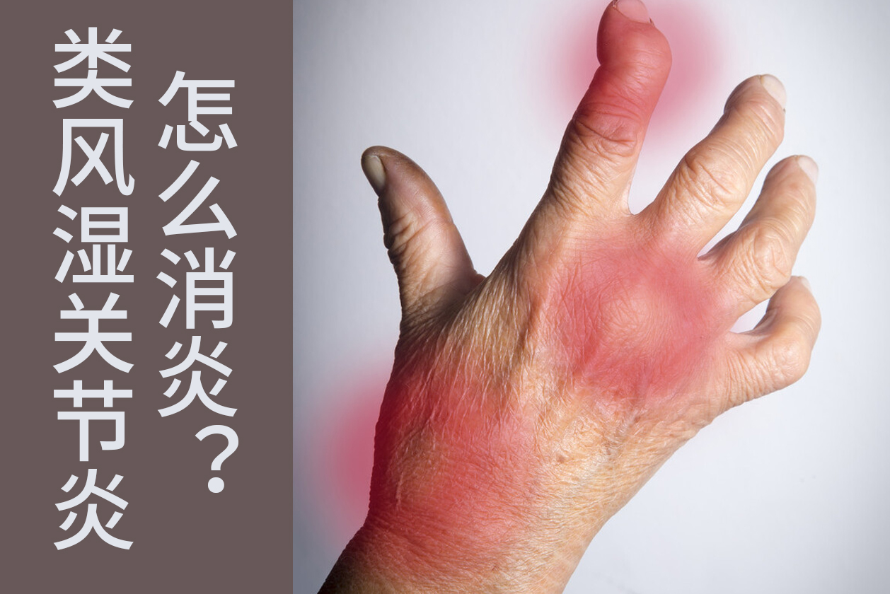 类风湿关节炎的炎症及关节破坏是如何发生发展的？如何正确消炎？