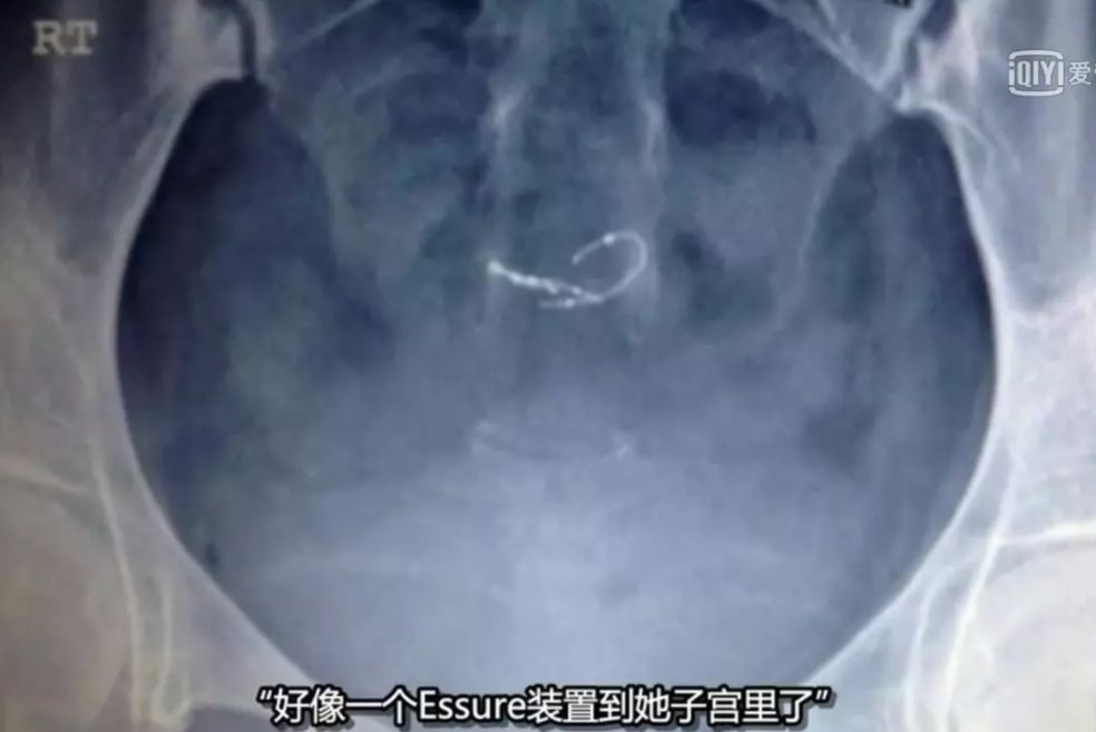 尖端医疗纪录片全集,纪录片高端医疗的真相