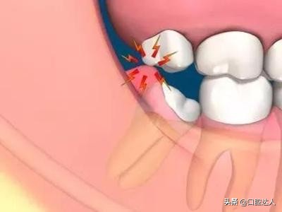 “它”可能给你的长假带来*麻大**烦！医生：早发现，早治疗