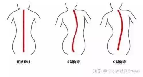 大兄弟，怎么年纪轻轻，你就弯了呢？