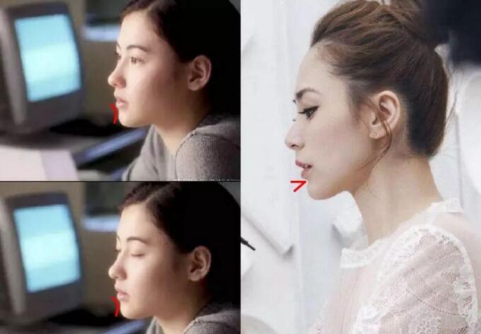 面部一枝花全靠鼻当家,论鼻子对颜值的重要性▼