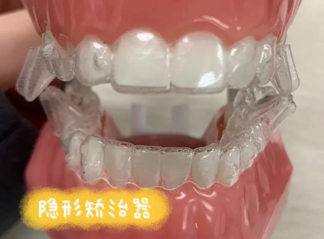 牙齿矫正能进考场吗,牙齿矫正高考有影响吗