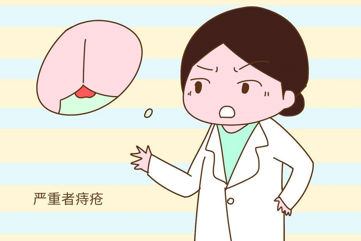 生孩子顺产的时候发现痔疮怎么办,每个产妇生完孩子都会长痔疮吗