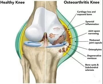 神速治愈膝关节炎,尽管我不是药神简谱