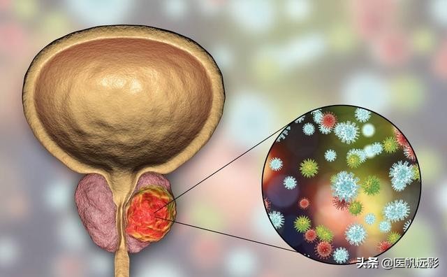 为什么性功能有问题却拿前列腺开玩笑？