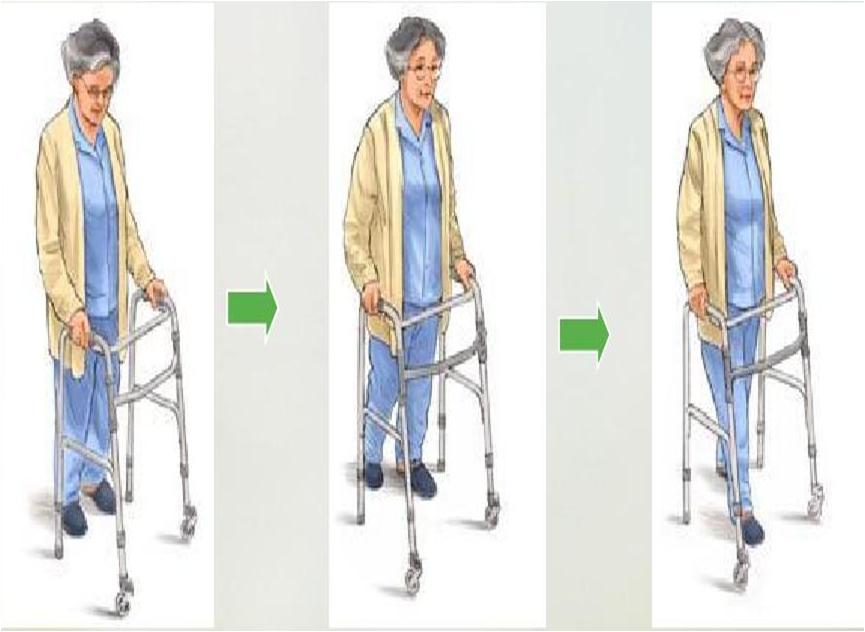 髋关节置换后多久能下床走路,髋关节置换后多久能下地负重