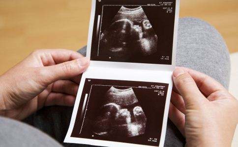 孕期b超没有羊水指数,孕期b超胎儿位置不好看不到