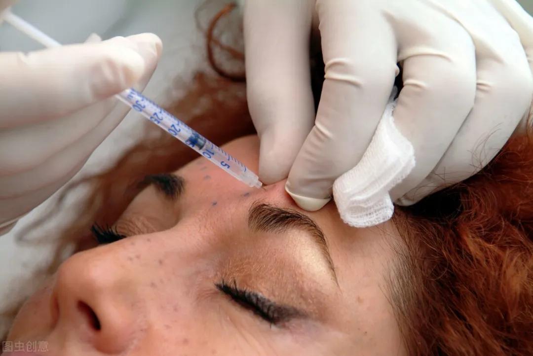 打除皱针没效果是什么原因,打除皱针不成功案例