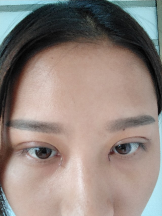 韩美做双眼皮,南昌韩美医院做双眼皮怎么样