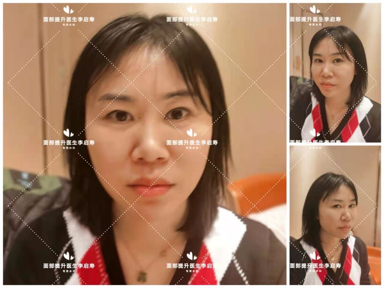 长脸型怎么让脸胖点,长脸型怎么改善变好看