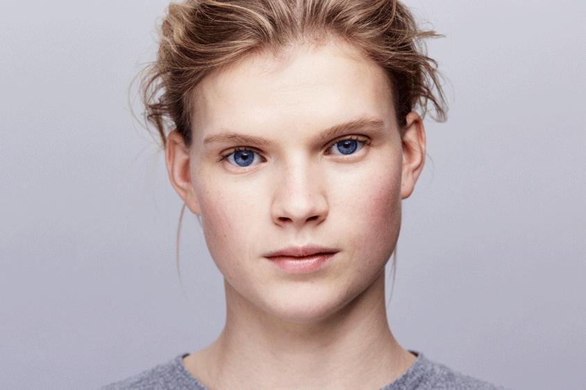 敏感肌换季过敏,敏感肌过敏是什么症状