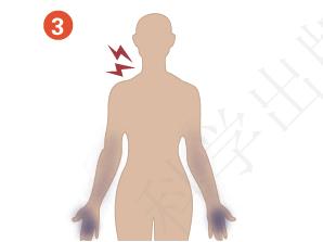 颈椎生理曲度变直有骨刺怎么办,颈椎x线片能看到什么吗