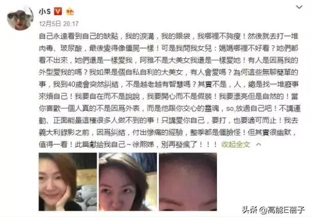 微整形需要多久,最受欢迎的5大微整形