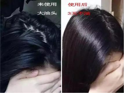 头发蓬松茶树油洗发水,油头救星澳洲茶树洗发水