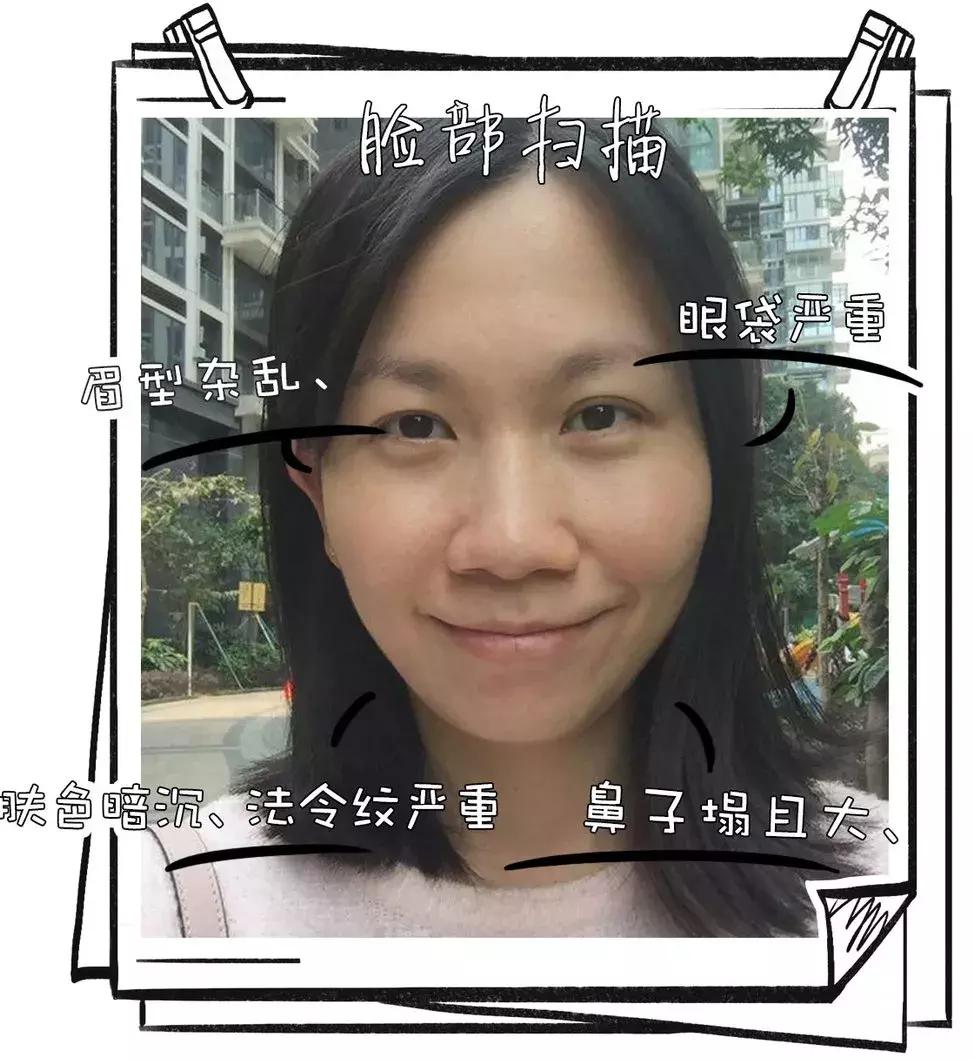 蒜头鼻怎么才能修成精致小翘鼻,如何让自己的蒜头鼻变成小巧鼻