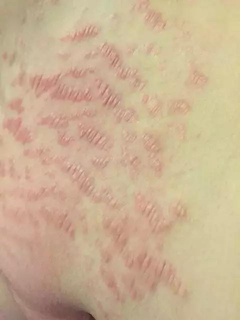 ella产后漏尿怎么办,ella产后尿失禁案例