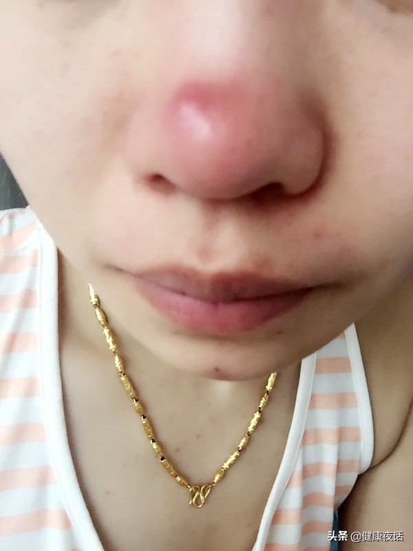 拔鼻毛对鼻腔的危害,有挖鼻屎的习惯是怎么回事