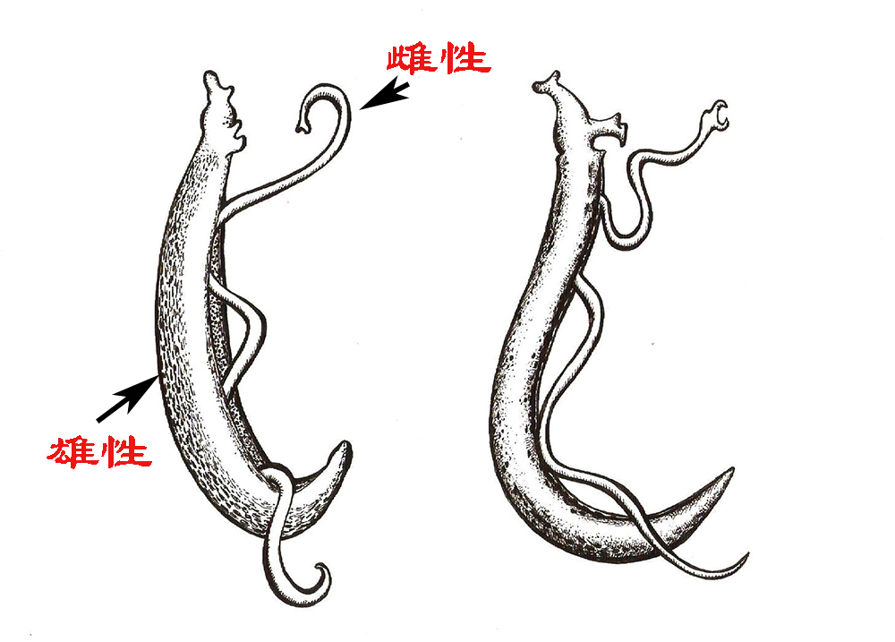 血吸虫会让肚子变大吗,血吸虫为何导致大肚子