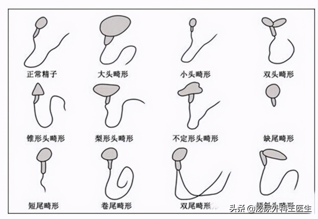 精子质量太差怎么能提高精子质量,人的精子干净程度