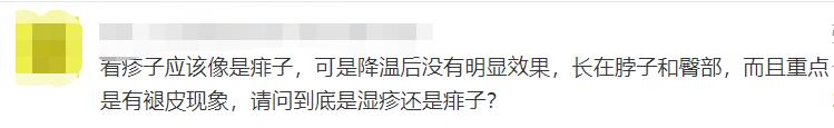 头上干性湿疹怎么护理,被湿疹折磨的宝宝