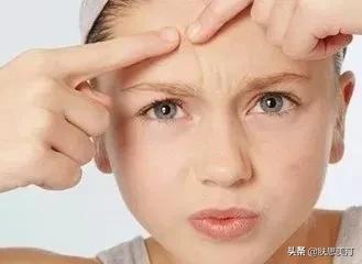 战痘消好用吗,战痘多年毫无成效你真的了解它吗