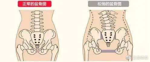 胯宽腰细怎么改善,胯宽骨盆修复管用吗