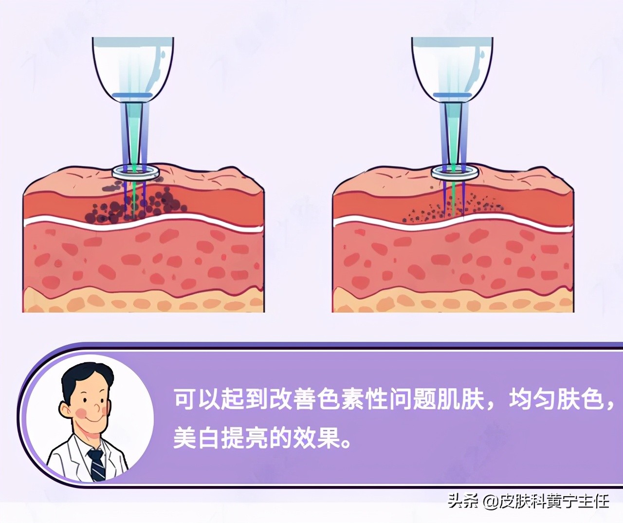 qlane鱼子酱祛斑胶囊真能祛斑吗,祛斑产品太多怎么办