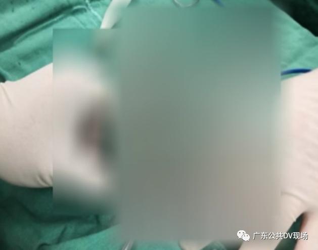 拖不起!男孩突然“蛋疼”不止,隔天送医被切除