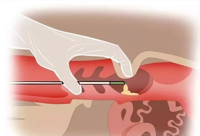 牛人工授精的正确方法和步骤,牛人工授精后两三天流血怎么回事