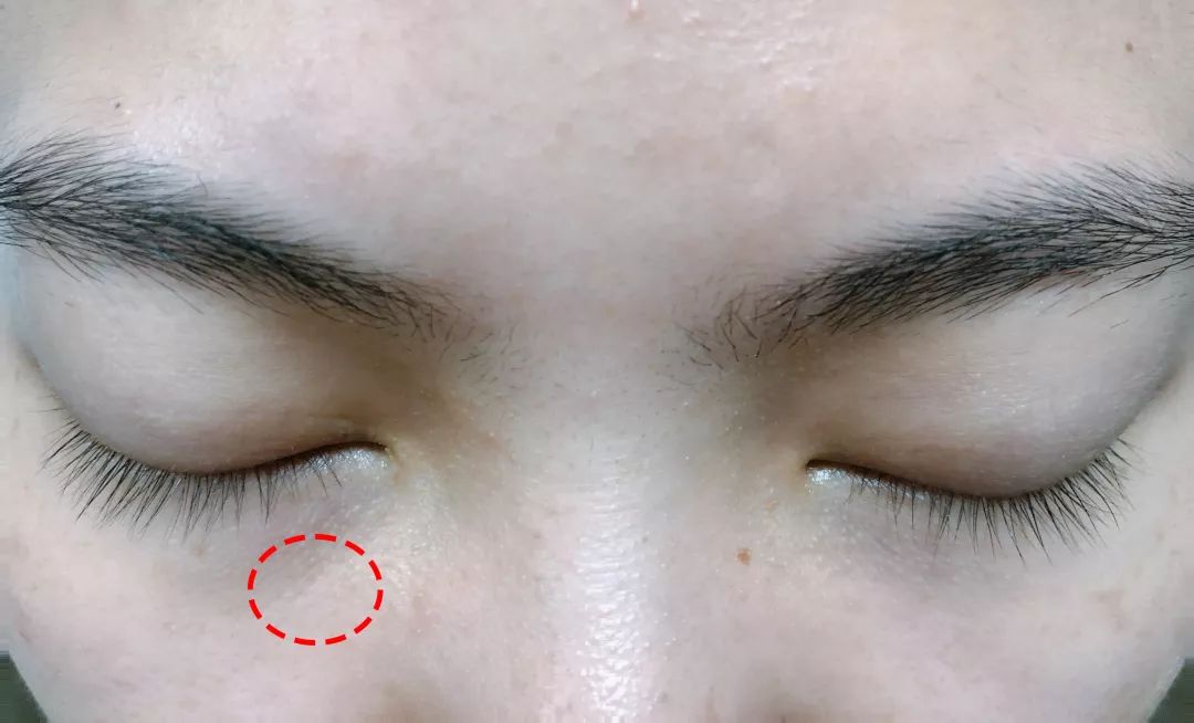 眼霜到底有没有用啊,眼霜里面有什么成分不能用